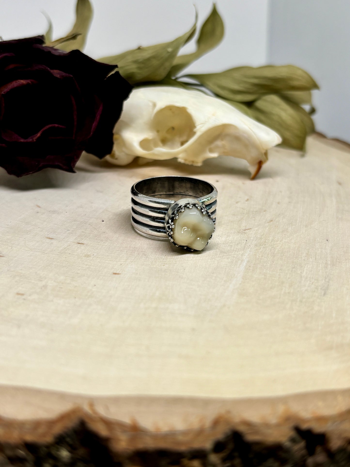 Tooth Ring